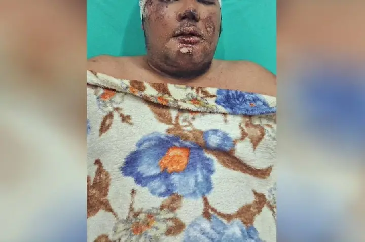 Danilo Silva segue internado no Heuro após duas cirurgias; quadro inspira cuidados, mas evolução é considerada positiva