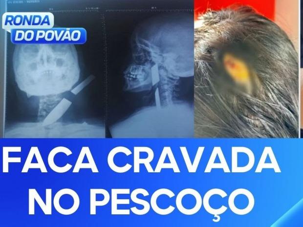 Após briga com ex, mulher fica com faca encravada no pescoço