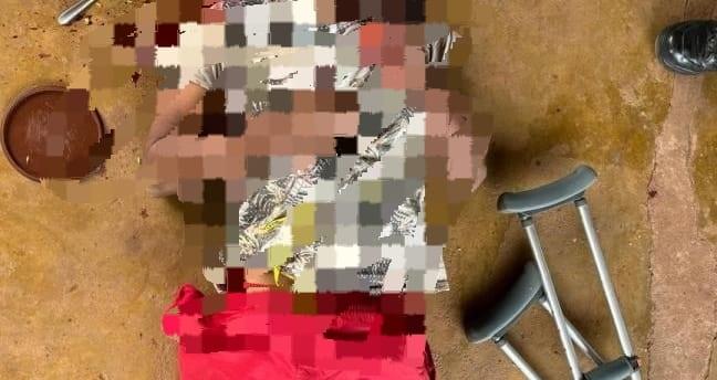 Tio agredido pelo sobrinho em Alvorada do Oeste, não resiste e morre em hospital de Cacoal