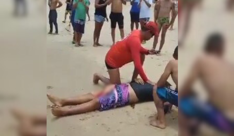 CENA FORTE: adolescente atacado por tubarão tem perna amputada