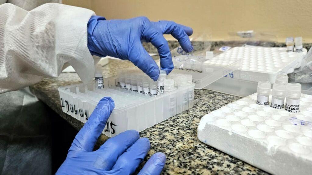 AM registra 7 óbitos por SRAG nas primeiras sete semanas de 2025