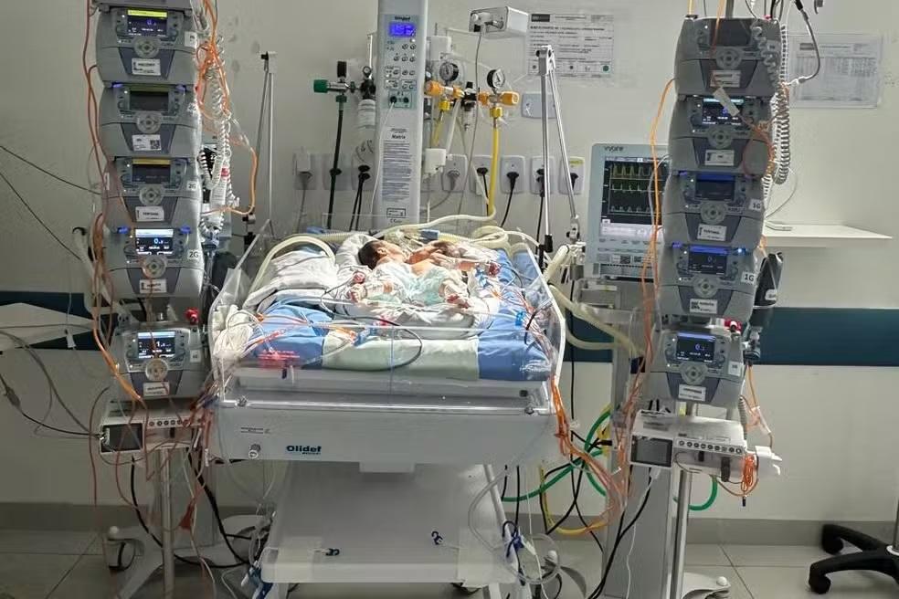 Gêmeas siamesas de Rondônia morrem após complicações cardíacas em Goiânia