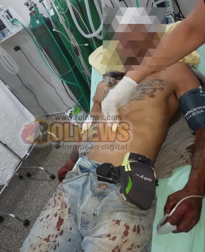 Homem é agredido com pedaço de madeira e sobrevive a tentativa de homicídio em Alta Floresta d’Oeste