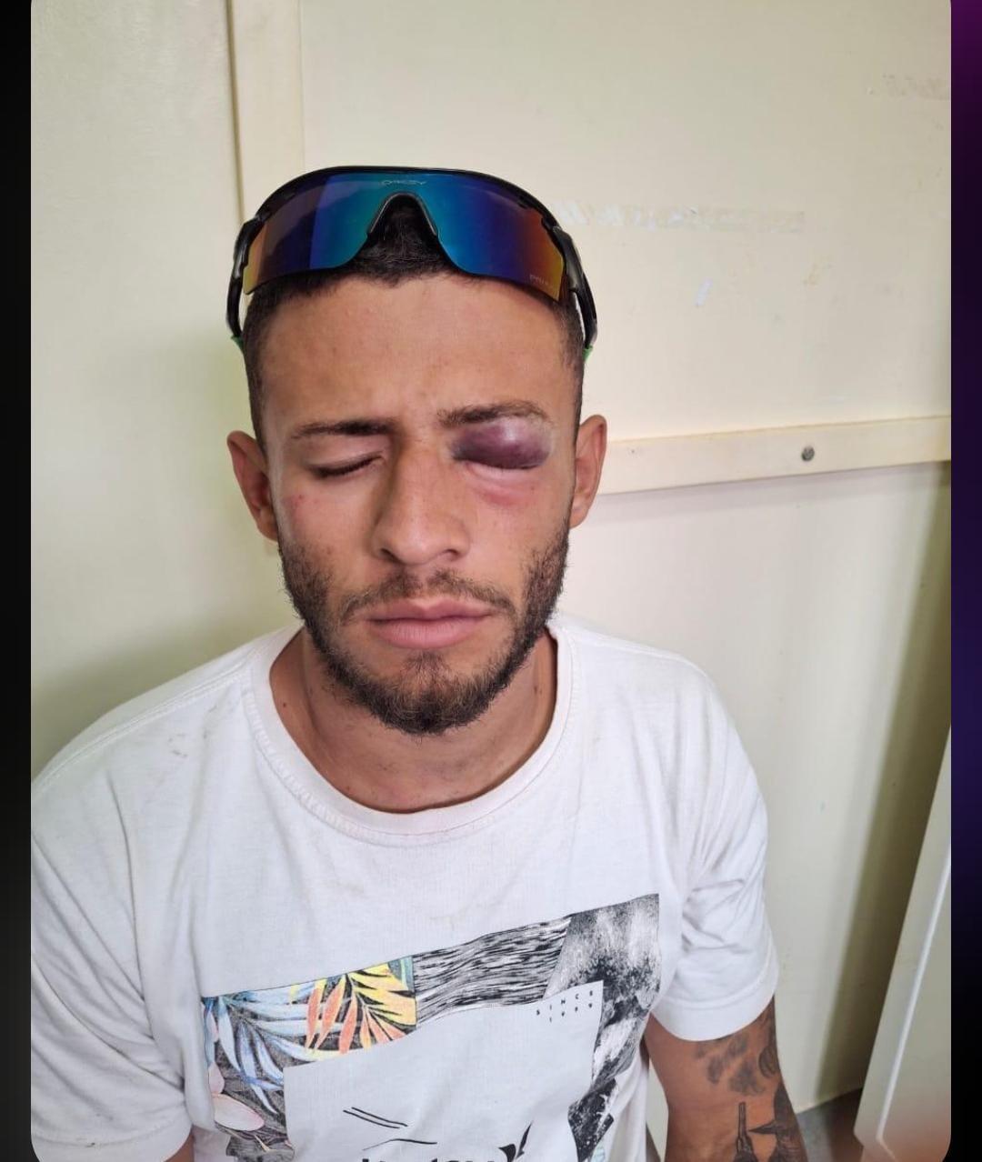 REPERCUTE NO PAÍS, SESSÃO DE TORTURA RECHEADA DE CHUTES DE COTURNO, SOCOS, GOLPES DE TELEFONE E TAPAS NA CARA NO MOTOQUEIRO