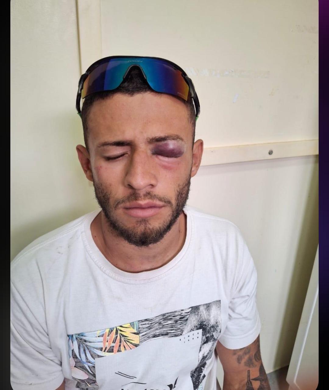 SEM O RIGOR DA CORREGEDORIA E OUVIDORIA DA PM, GUARNIÇÕES DE RUAS DA 4ª CIA/PM DO COMANDO DE LÁBREA MANDAM NOVA VÍTIMA DE ESPANCAMENTO E TORTURA