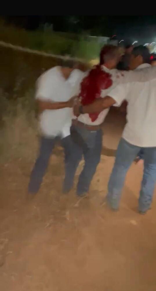 Jaru: Antônio do Burro é alvo de atentado em festa de laço no 180