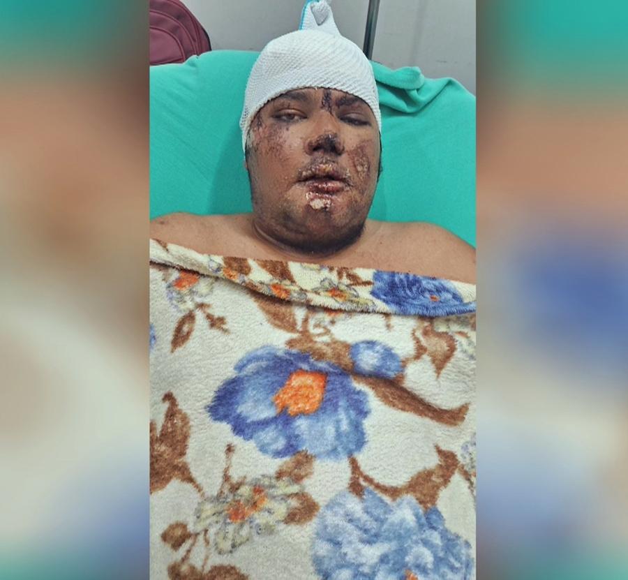 Danilo Silva segue internado no Heuro após duas cirurgias; quadro inspira cuidados, mas evolução é considerada positiva