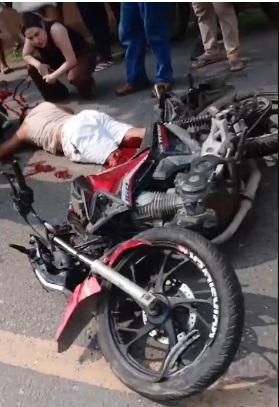 IMAGENS FORTES: Motociclista tem perna amputada após colisão com ônibus no Tarumã-Açu
